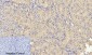 p53 Polyclonal Antibody